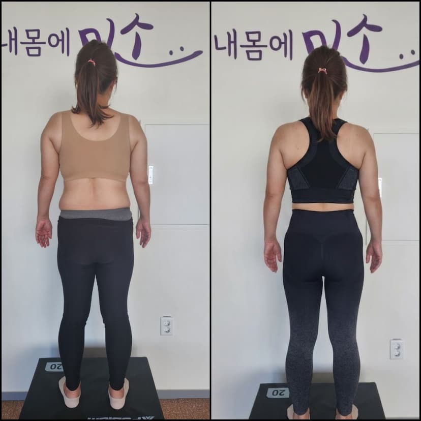 체형교정 비포에프터 3